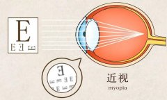 <b>别再问“度娘”了！成年人也有可能假性近视，判断方法很简单</b>