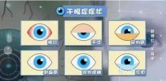 孩子也会有干眼症？
