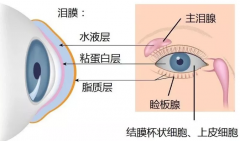 不摘隐形眼镜睡觉，对眼睛有危害吗？